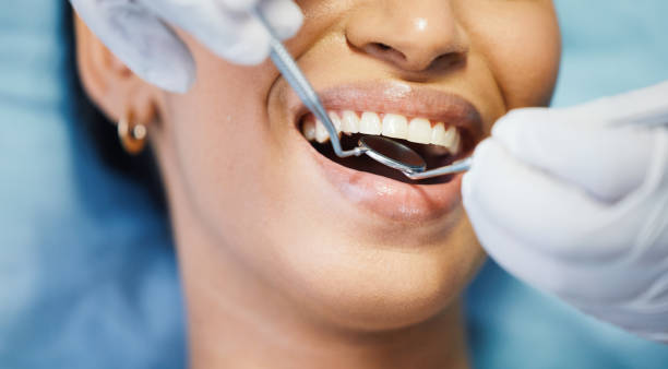 Best Same-Day Emergency Dentist in Montesano, WA