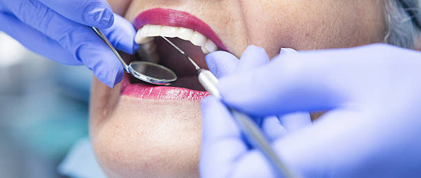 Best Emergency Wisdom Teeth Removal in Montesano, WA